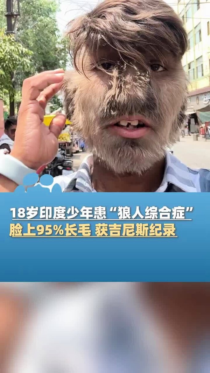 欧美一区二区三区区成人影院欧美的相关介绍